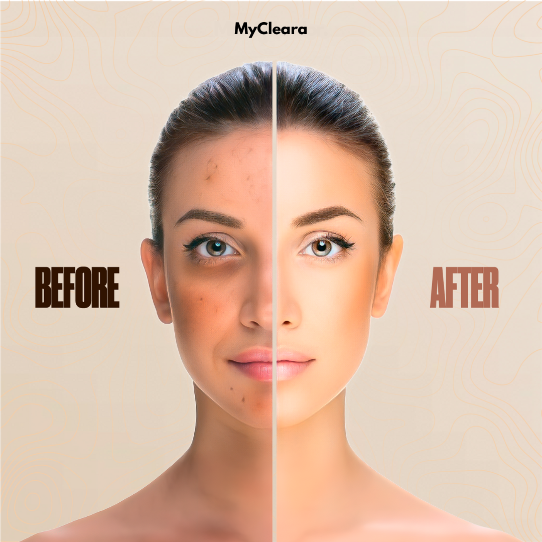 Serum Boosted Skin Tint Balm by Cleara